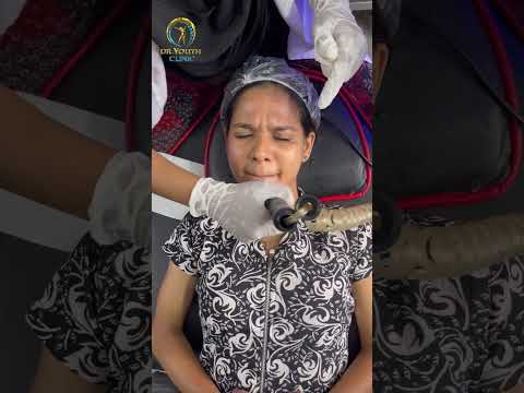 Hydrafacial Procedure Ssramya DR Youth Clinic Anna Nagar Chennai
